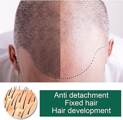 713WG3WN0eL._AC_SX425_